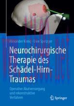 [PDF]Neurochirurgische Therapie des Sch&auml;del-Hirn-Traumas: Operative Akutversorgung und rekonstr...