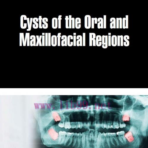 [AME]Cysts Of The Oral And Maxillofacial Regions (Original PDF)