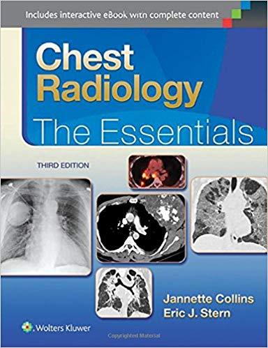 Chest Radiology - The Essentials, 3rd Edition