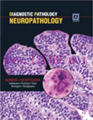 [CHM]Diagnostic Pathology - Neuropathology, 1st Edition