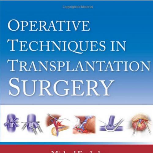 Operative Techniques in Transplantation Surgery