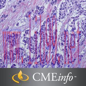[AME]Soft Tissue Tumors &ndash; Masters of Pathology Series 2018 (CME Videos)