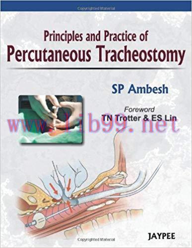 [PDF]Principles and Practice of Percutaneous Tracheostomy