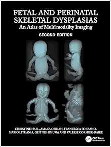 [AME]Fetal and Perinatal Skeletal Dysplasias: An Atlas of Multimodality Imaging 2e (Original PD...