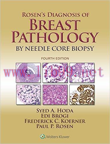 [AME]Rosen’s Diagnosis of Breast Pathology by Needle Core Biopsy, 4th Edition (EPUB)