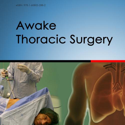 Awake Thoracic Surgery_nodrm - Pompeo, Eugenio(Author)