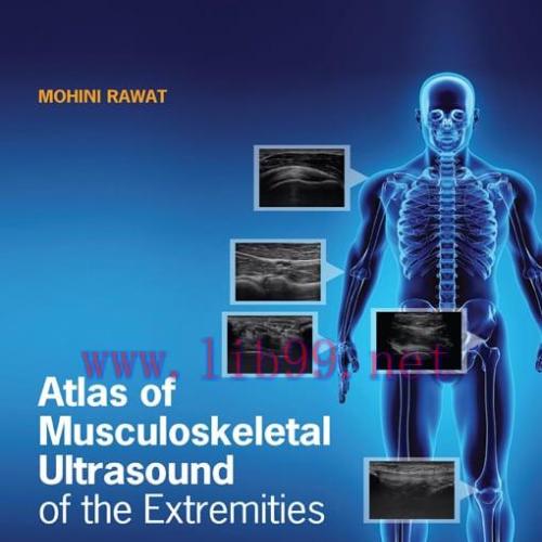[AME]Atlas of Musculoskeletal Ultrasound of the Extremities (EPUB)