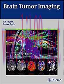 [PDF]Brain Tumor Imaging