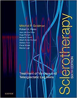 (PDF)Sclerotherapy E-Book: Treatment of Varicose and Telangiectatic Leg Veins (Expert Consult) ...