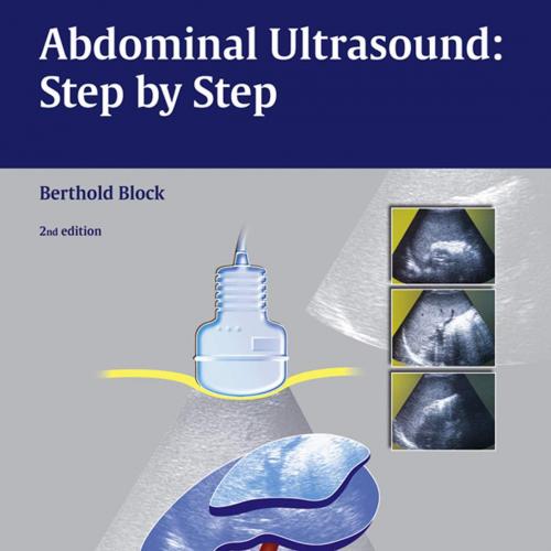 Abdominal Ultrasound Step by Step 2nd