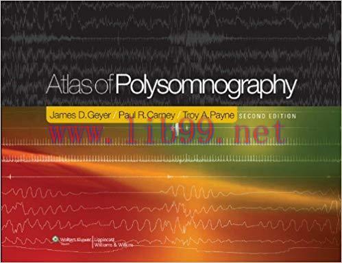 [PDF]Atlas of Polysomnography, 2nd Edition