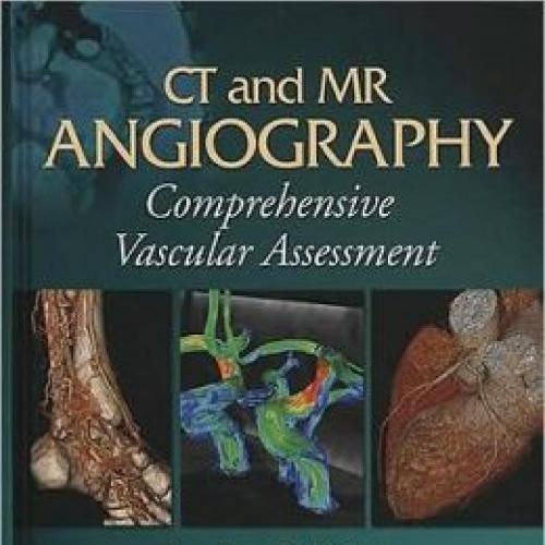 CT and MR Angiography-Comprehensive Vascular Assessment