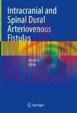 [PDF]Intracranial and Spinal Dural Arteriovenous Fistulas