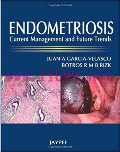 [PDF]Endometriosis: Current Management and Future Trends