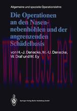 [PDF]Die Operationen an den Nasennebenh&ouml;hlen und der angrenzenden Sch&auml;delbasis