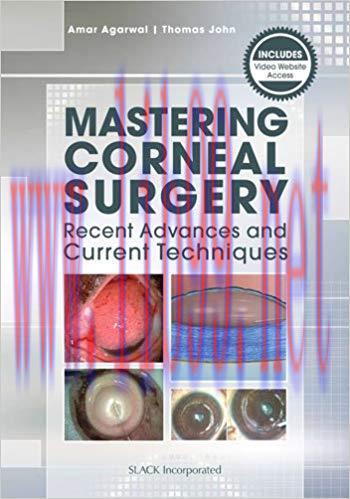 [PDF]Mastering Corneal Surgery