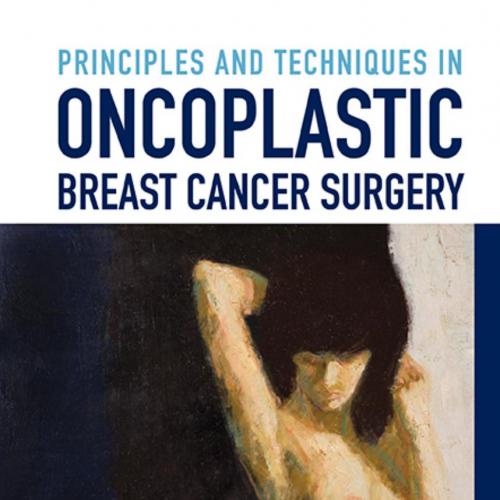 Principles and Techniques in Oncoplastic Breast Cancer Surgery