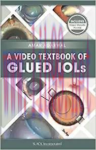 [PDF]A Video Textbook of Glued IOLs
