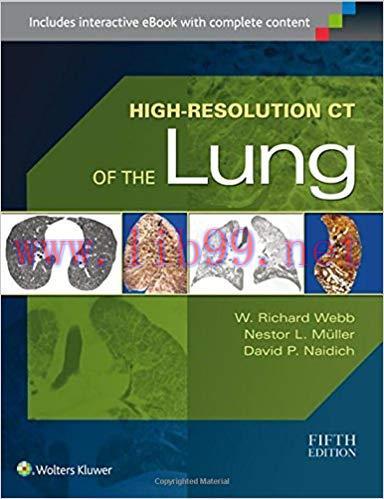 [PDF]High-Resolution CT of the Lung 5th Edition+CHM版