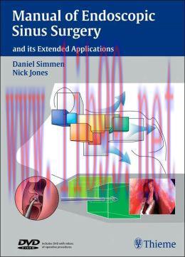 [AME]Manual of Endoscopic Sinus Surgery: and its Extended Applications
