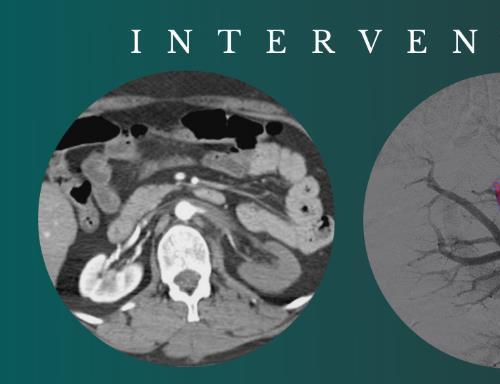 [AME]CME Science Interventional Radiology Stephen T. Kee, M.D 2021 (CME VIDEOS)