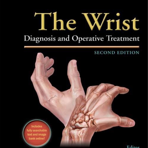 Wrist Diagnosis and Operative Treatment, 2nd Edition, The - Wei Zhi