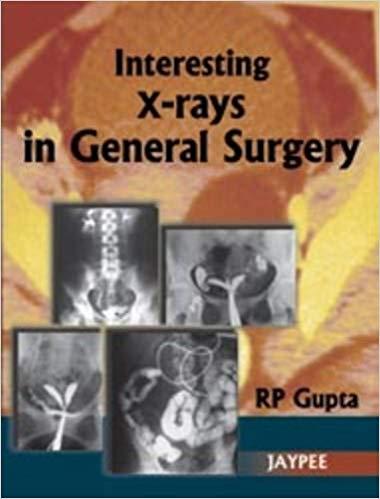 Interesting X-rays in General Surgery