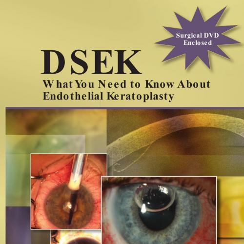 DSEK-What You Need to Know About Endothelial Keratoplasty