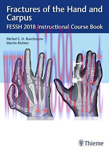 [AME]Fractures of the Hand and Carpus: FESSH 2018 Instructional Course Book (Original PDF)