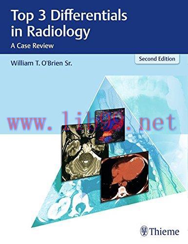 [AME]Top 3 Differentials in Radiology: A Case Review, 2nd Edition (EPUB)