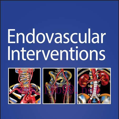 [PDF]Endovascular Interventions