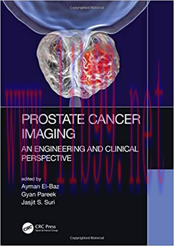 [PDF]Prostate Cancer Imaging