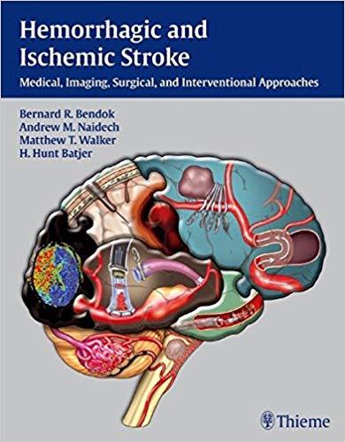 Hemorrhagic and Ischemic Stroke + Video