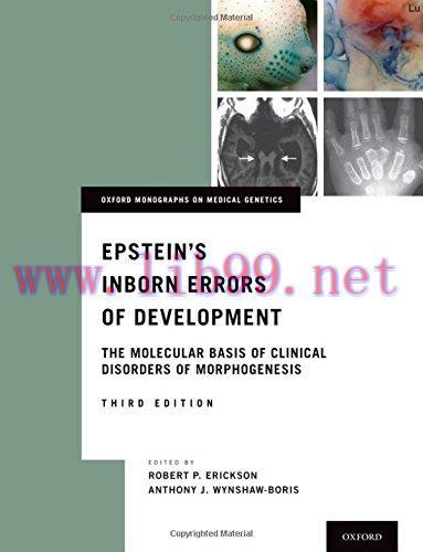 [AME]Epstein&rsquo;s Inborn Errors of Development: The Molecular Basis of Clinical Disorders of Morph...