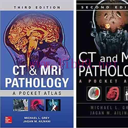 [PDF]CT and MRI Pathology A Pocket Atlas, 3rd Edition + 2e