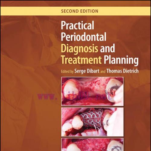 [AME]Practical Periodontal Diagnosis and Treatment Planning, 2nd Edition (EPUB)