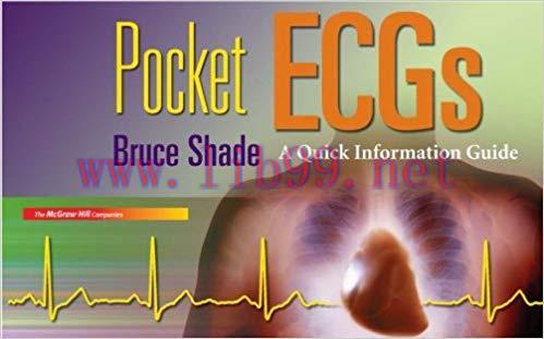 (PDF)Pocket ECGs: A Quick Information Guide 1st Edition