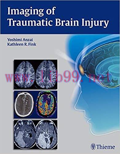 [PDF]Imaging of Traumatic Brain Injury