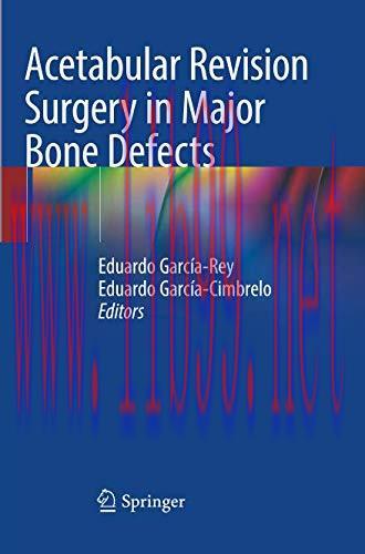 [AME]Acetabular Revision Surgery in Major Bone Defects (EPUB)
