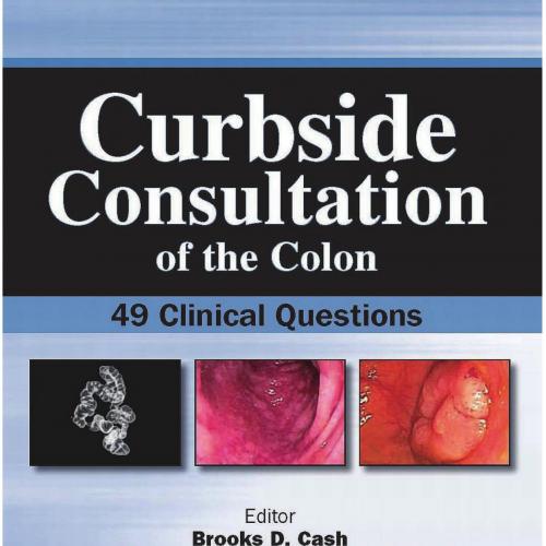 Curbside Consultation of The Colon-49 Clinical Questions