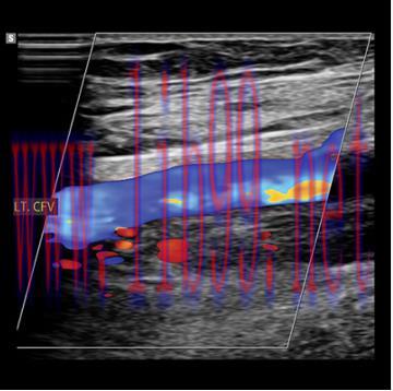 [AME]Clinical Approach to Vascular Ultrasound and RPVI Prep Course 2023 (Videos)