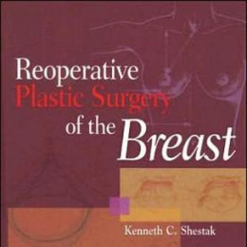 Reoperative Plastic Surgery of the Breast