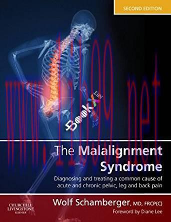 [PDF]The Malalignment Syndrome, 2nd Edition