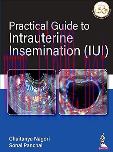 [AME]Practical Guide To Intrauterine Insemination (IUI) (Original PDF)