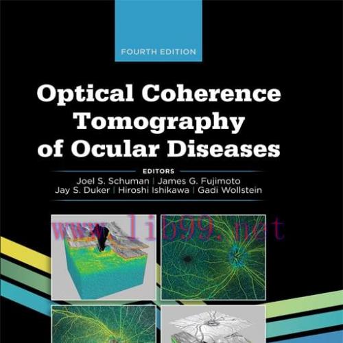 [AME]Optical Coherence Tomography of Ocular Diseases, 4th Edition (EPUB)