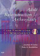 [AME]Core Knowledge in Orthopaedics: Adult Reconstruction and Arthroplasty, 1e (Original PDF)