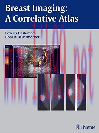 [PDF]Breast Imaging - A Correlative Atlas