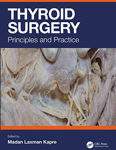 Thyroid Surgery Principles and Practice 1st Edition