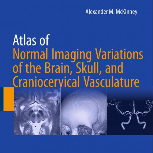Atlas of Normal Imaging Variations of the Brain, Skull, and Craniocervical Vasculature