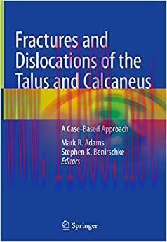 (PDF)Fractures and Dislocations of the Talus and Calcaneus: A Case-Based Approach 1st Edition